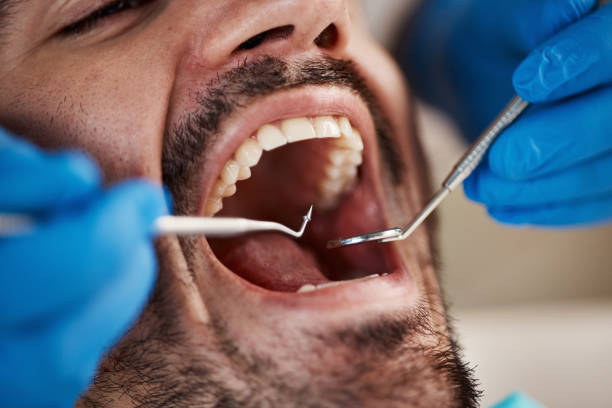 Best Dental Fillings (Composite and Amalgam)  in Mount Vernon, IL